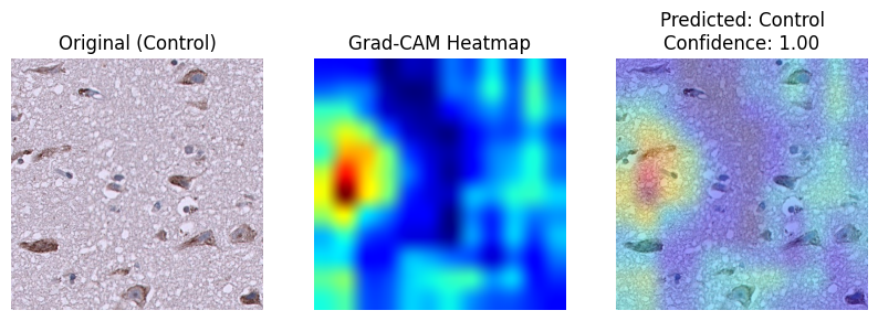 Grad-CAM visualisation of Control class